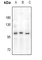 Androgen Receptor Pab