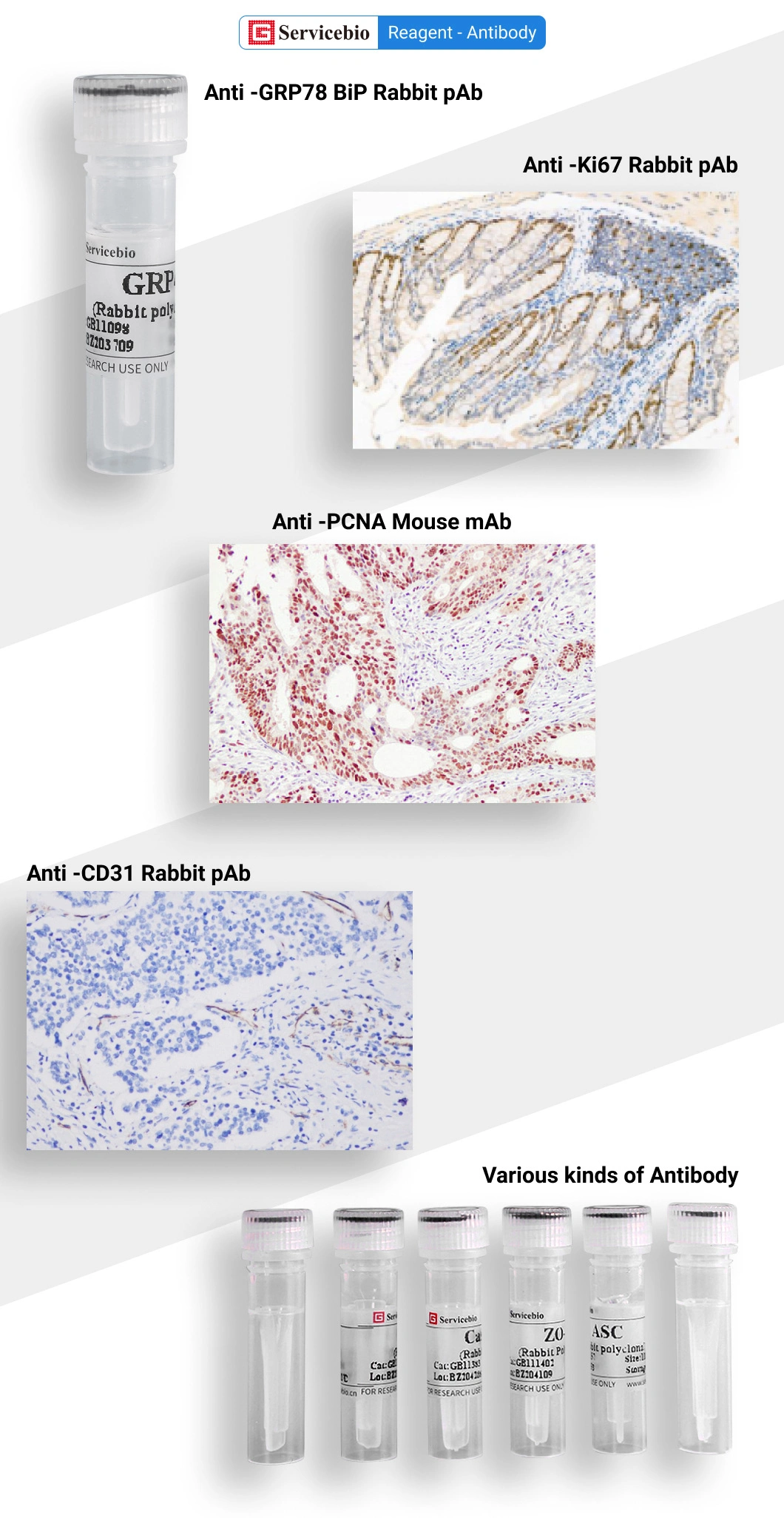 Biological Mouse Mab Primary Recombinant Anti-Gapdh Antibody