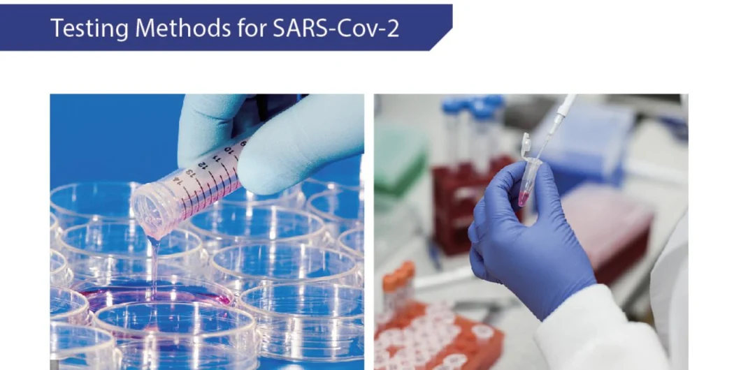 Medomics Neutralizing Rapid Antibody Test Elisa Kit 2023