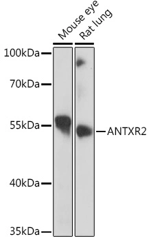 Поликлональное антитело Antxr2